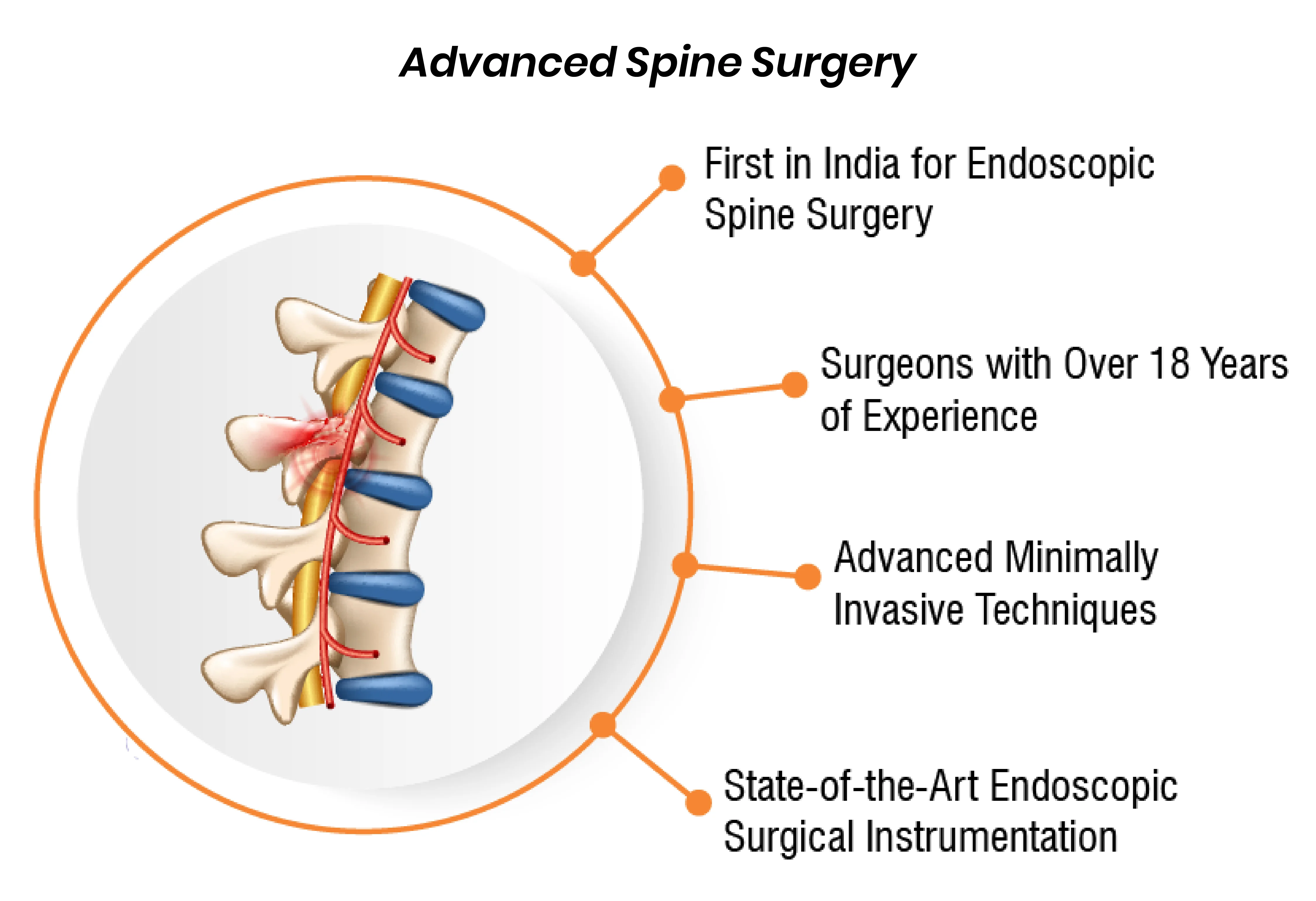 Spine Surgery